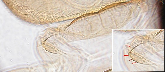 The shoulder bristle of liposcelis bostrychophila. The shoulder bristle of liposcelis bostrychophila.