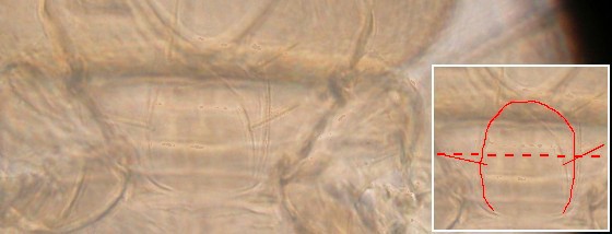 Prosternal bristles located posterior to the middle of prosternum. Prosternal bristles located posterior to the middle of prosternum.