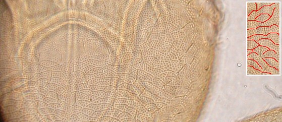 Areoles of vertex. Areoles of vertex.