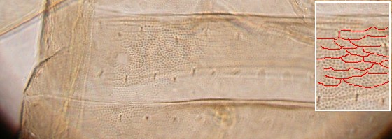 Abdominal areoles. Abdominal areoles.