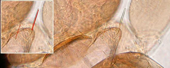Single supplementary bristle on each lateral pronotal lobe liposcelis brunnea. Single supplementary bristle on each lateral pronotal lobe liposcelis brunnea.