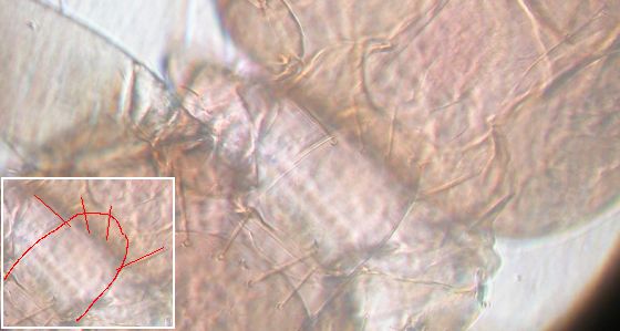 Prosternal bristles anterior to middle of prosternum. Prosternal bristles anterior to middle of prosternum.
