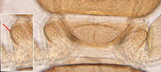 The shoulder bristle of liposcelis corrodens. The shoulder bristle of liposcelis corrodens.