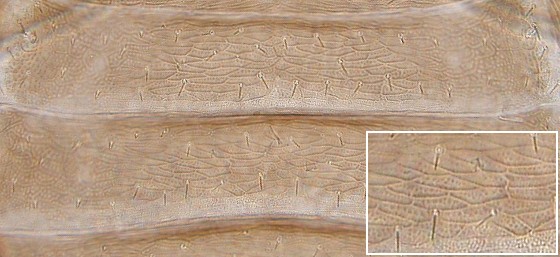Abdominal areoles. Abdominal areoles.