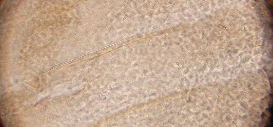 Abdominal areoles. Abdominal areoles.