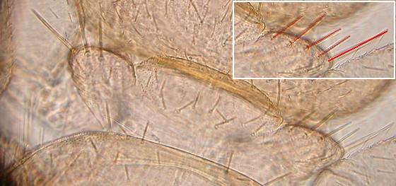 The shoulder bristle. The shoulder bristle.