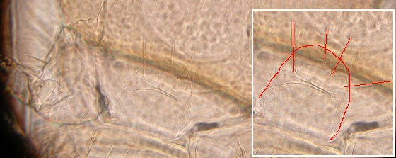 Prosternal bristles anterior to middle of prosternum. Prosternal bristles anterior to middle of prosternum.