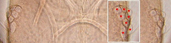 Eight ommatidia of liposcelis entomophila. Eight ommatidia of liposcelis entomophila.