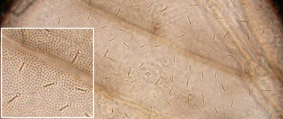 Abdominal terga. Abdominal terga.