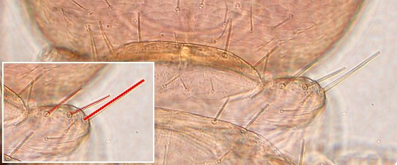 The shoulder bristle of liposcelis fusciceps. The shoulder bristle of liposcelis fusciceps.