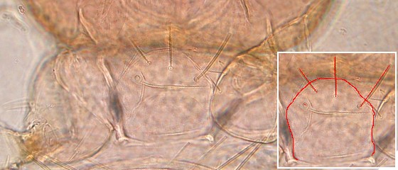 Prosternal bristles anterior to middle of prosternum. Prosternal bristles anterior to middle of prosternum.