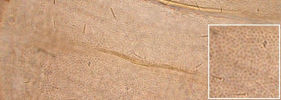 Meso-metathoracic and abdominal terga sculpture. Meso-metathoracic and abdominal terga sculpture.