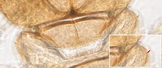 The shoulder bristle of liposcelis paeta. The shoulder bristle of liposcelis paeta.