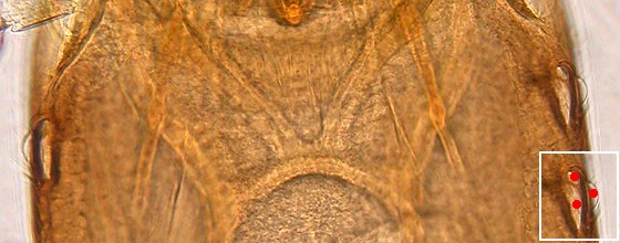 Three ommatidia. Three ommatidia.